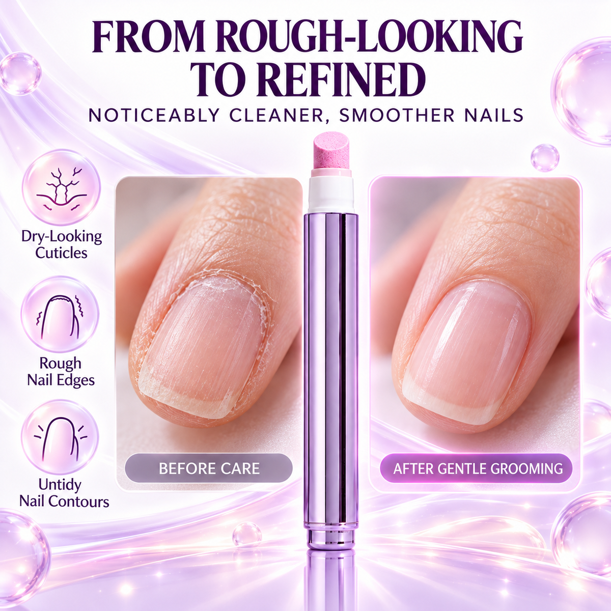 🔥LAST DAY UP TO 56% OFF.🔥3-in-1 Nail Care Essence Pen